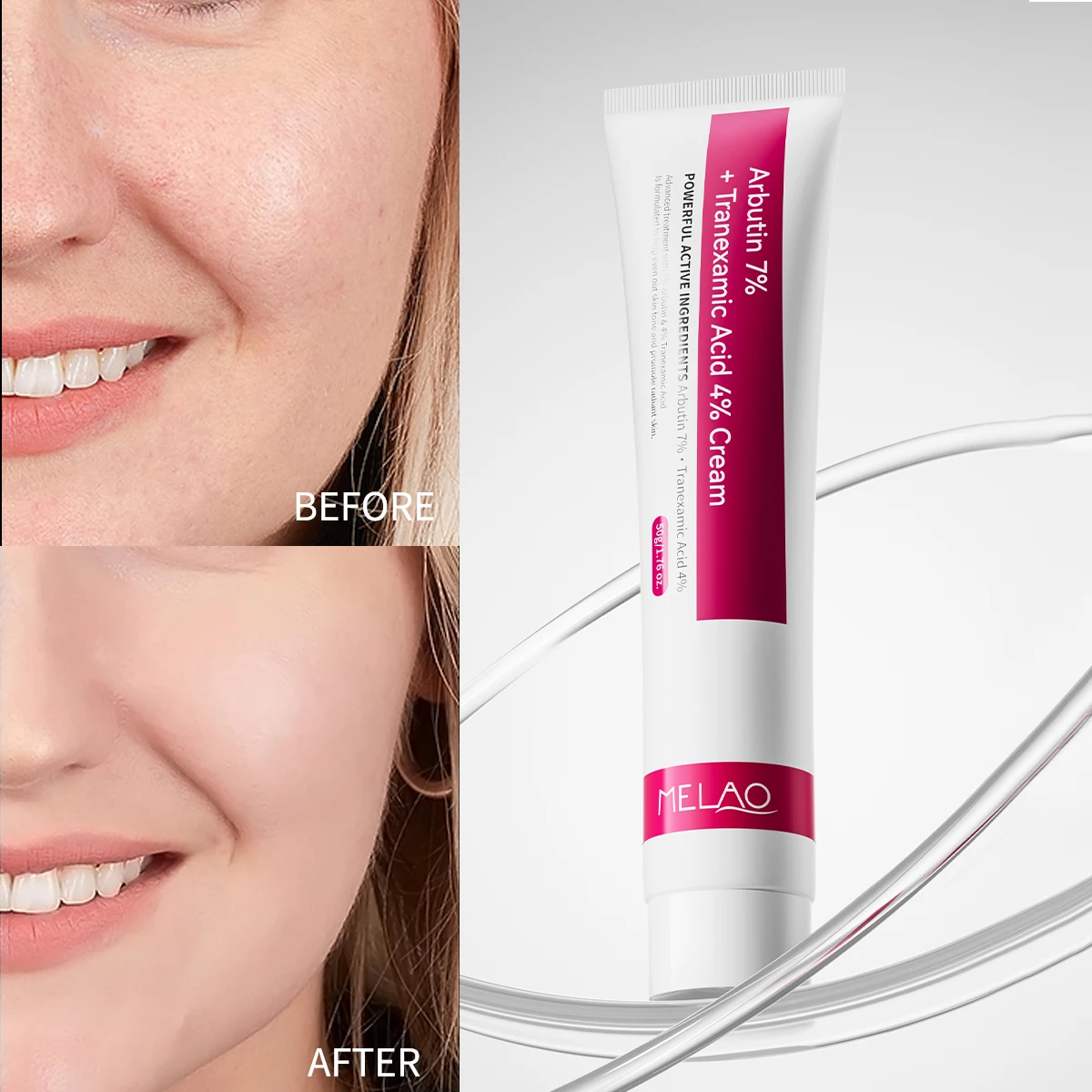 ArbutinSkinBooster. Tranexamic AcidCream Arbutin 8% + Tranexamic