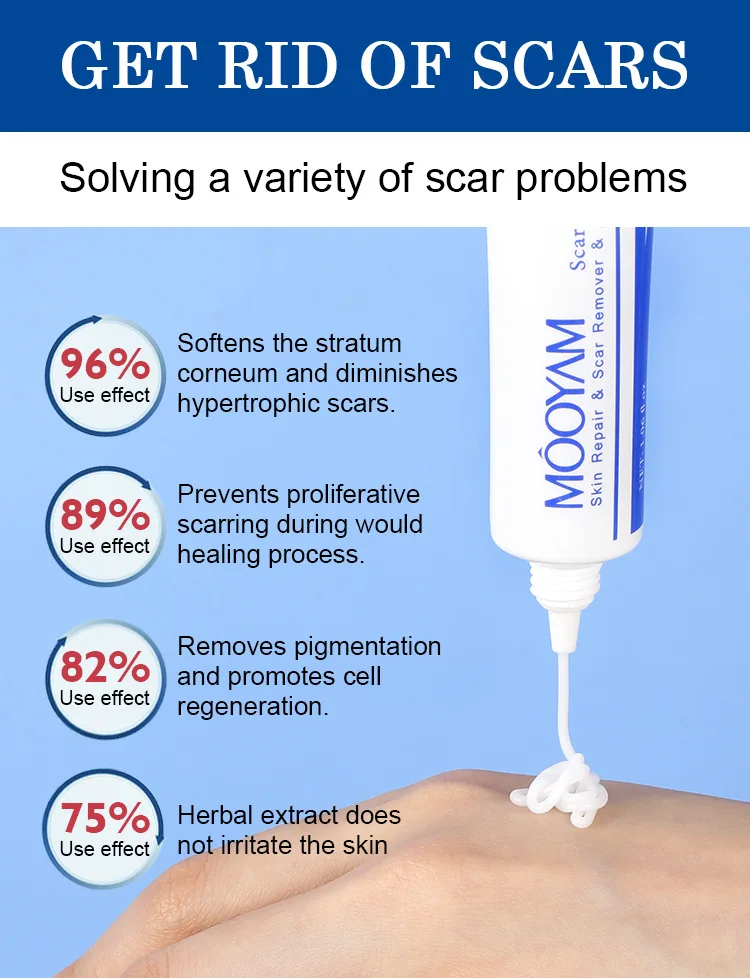 Strong Effective Acne Scar Removal Cream Pimples Stretch Marks Face Gel