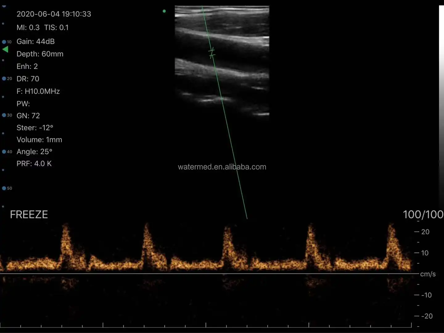 Linear/Convex/Phased Array 3 in 1 Handheld USB Ultrasound Double Probes ...