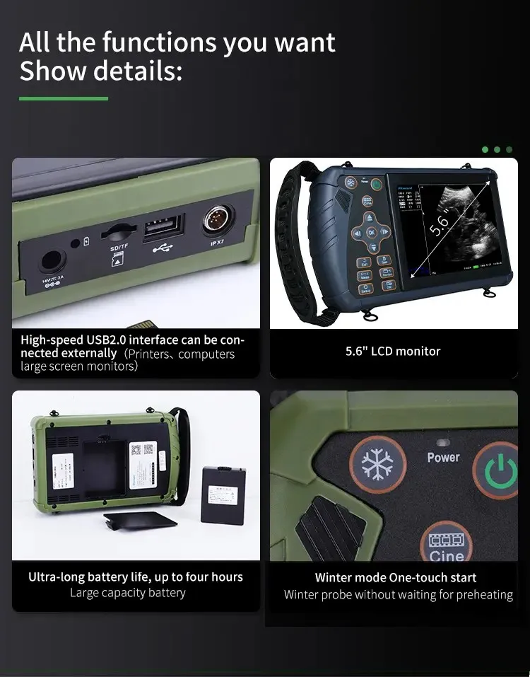 Laptop portable wireless ultrasound machine price convex/linear/micro-convex/rectal linear/backfat probe