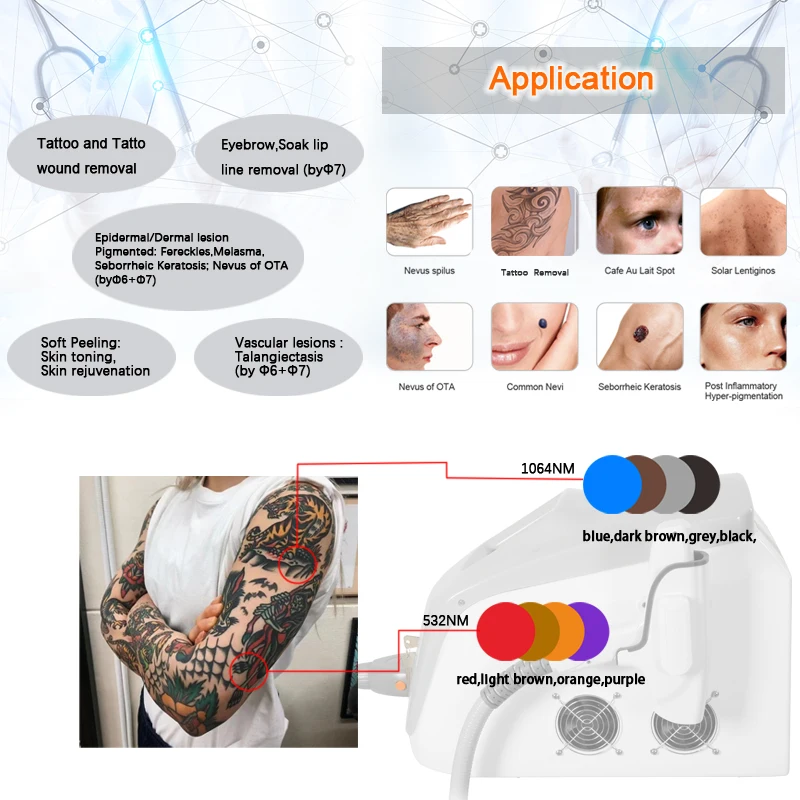 Factory Q-switch Nd Yag Pico Laser Tattoo Removal 1064 532 nm Beauty Instrument Machine