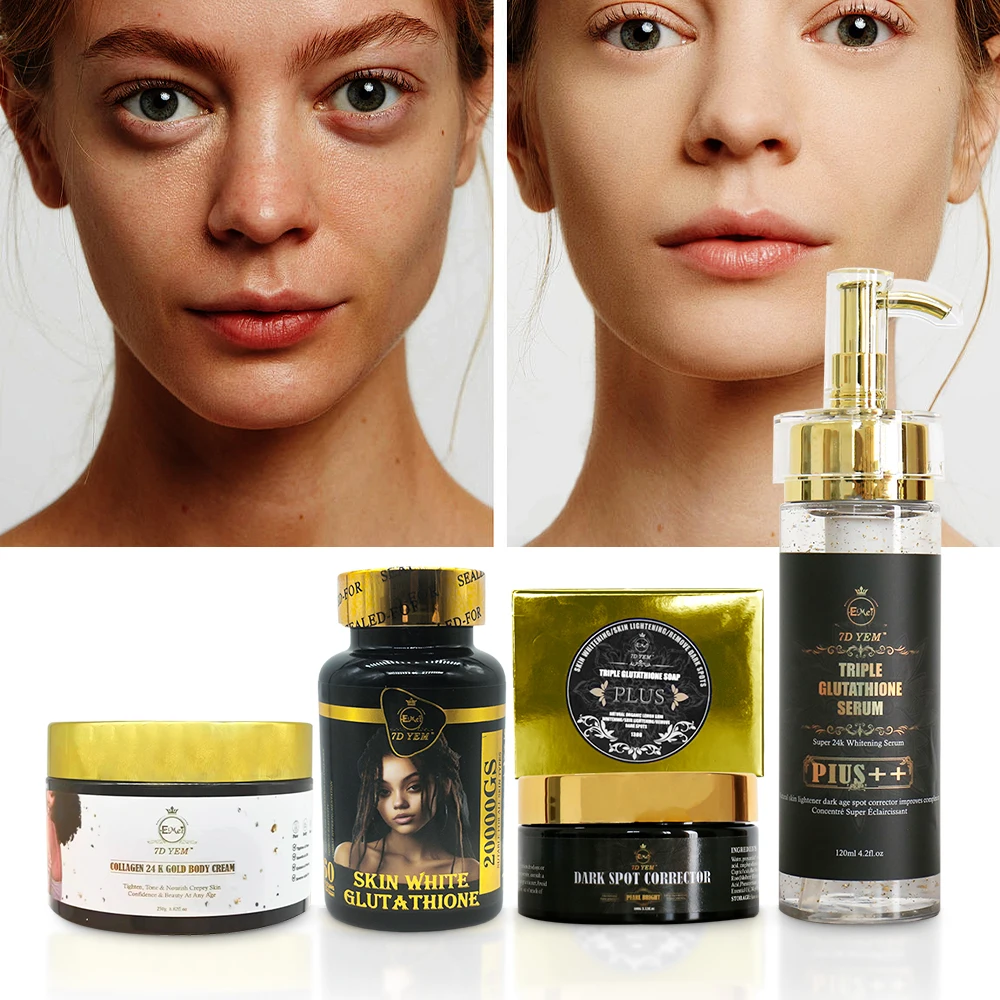 l-glutathione gold moist whitening lotion Private Label ODM Skin Care Set Anti Acne Brightening Body Moisturizer Glutathione Capsule Body for Adults Vitamin B12 Injection: Uses, Antioxidantien SELECT QUANTITY:3 Bottles