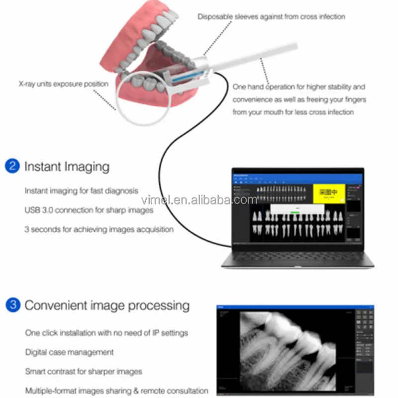 Rvg Eco I/ii Xrays Sensor With Holder Faster/recycle/durable Usb