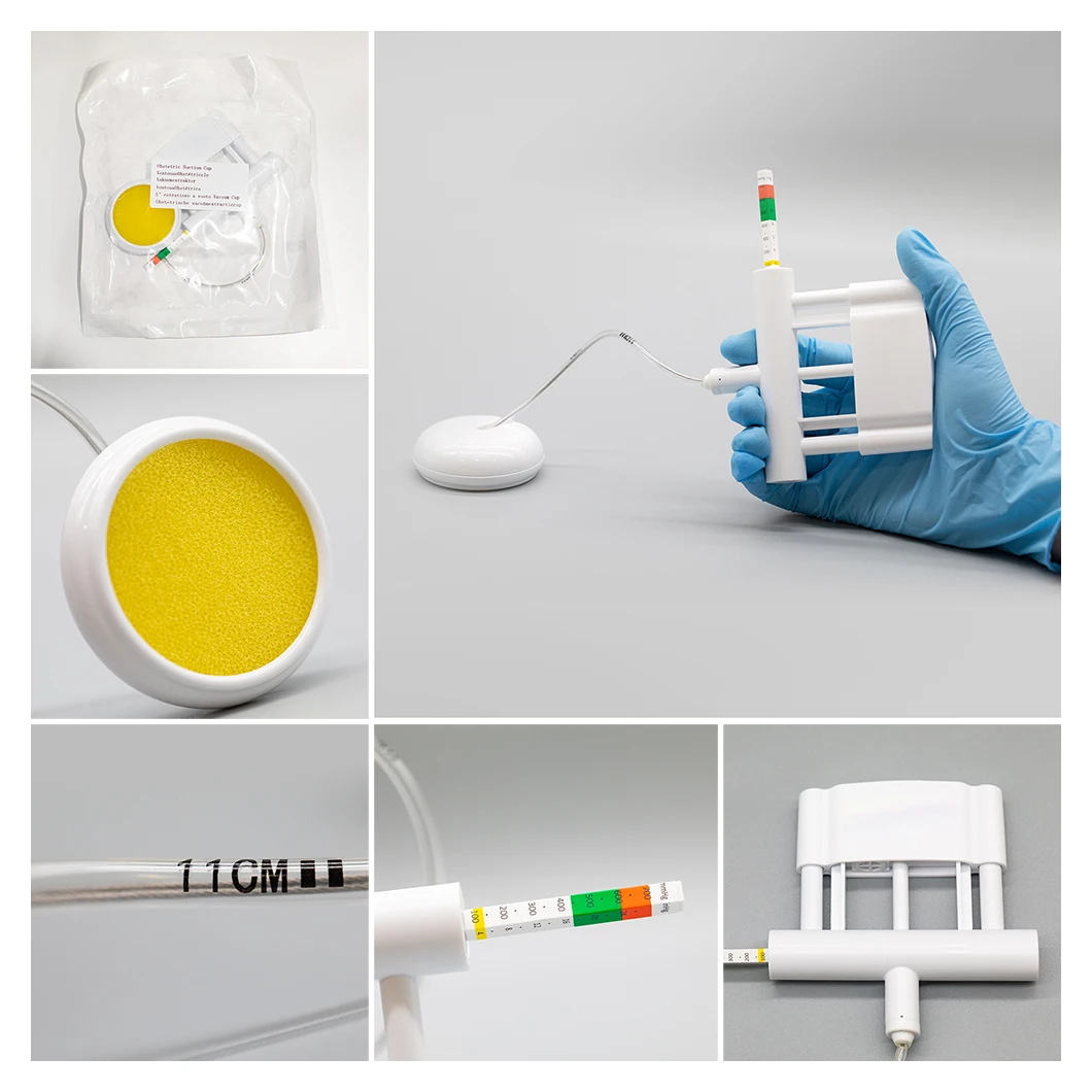 Disposable Fetal Head Vacuum Extraction Delivery System Obstetric