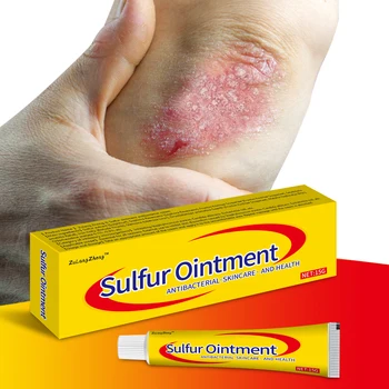 ZuLangZhong Topical Anti Fungal Skin Antibacterial Mite Cream Sulfur Ointment 15G