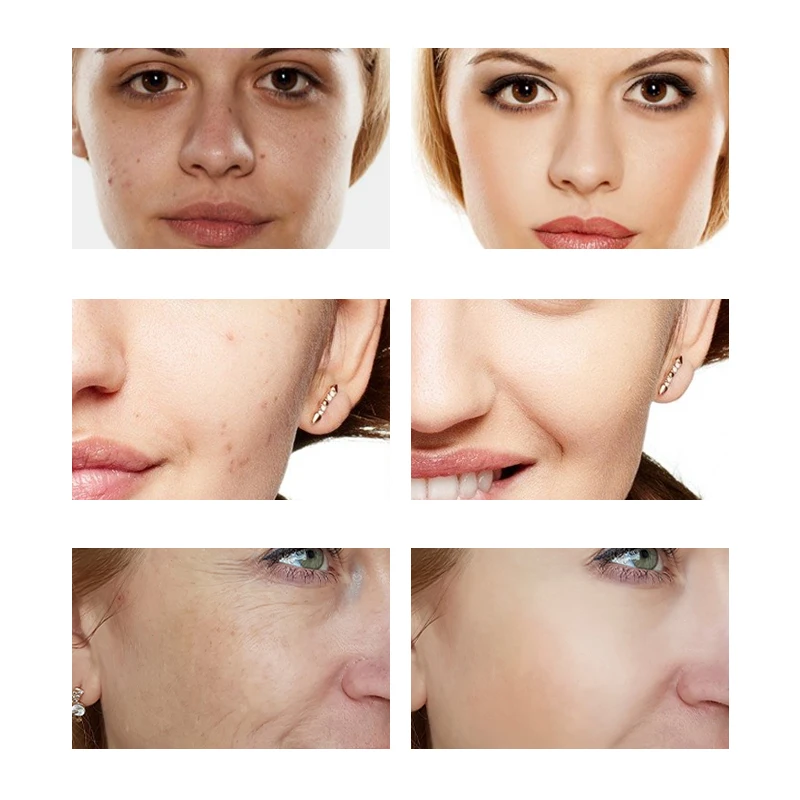 
OEM/ODM Фирменная этикетка под заказ, ампула концентрат гиалуроновой кислоты, коллаген, восстанавливающие увлажняющие сыворотки 