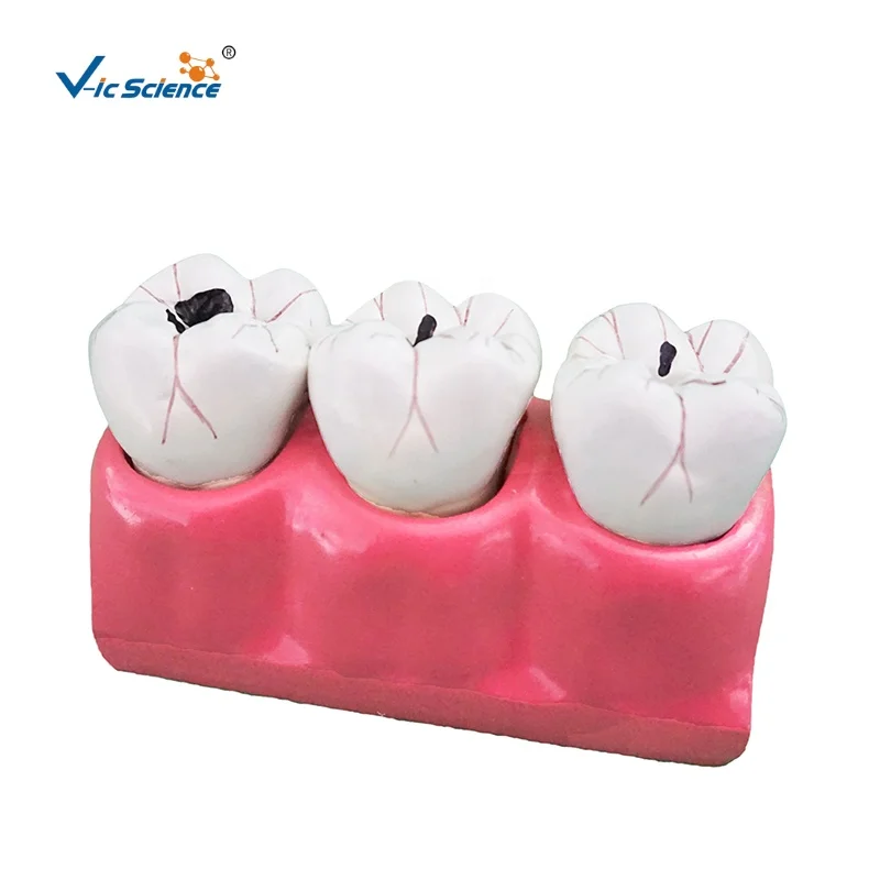 その他 NISSIN DENTAL MODEL Nissin Dental Model - Nissin Dental Model