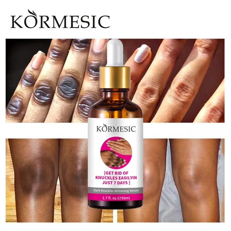 OEM KORMESIC Private Label Dark Knuckles Fast Whitening Serum Hand Knuckle Elbows Knee Intense Stains Remover Serum
