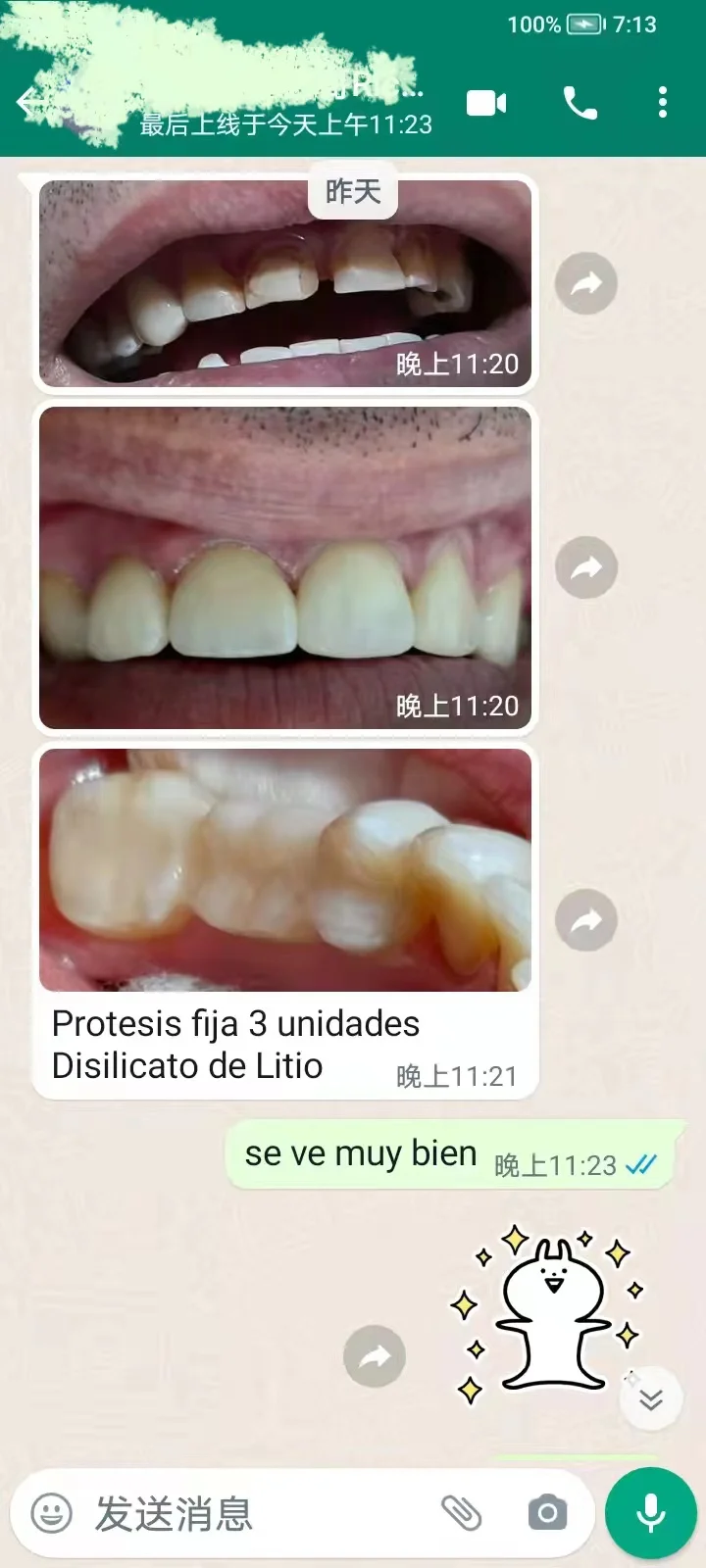 YUCERA ST White High Strength Dental Lab Zirconia Blocks 43% High Translucent Zirconia Disc