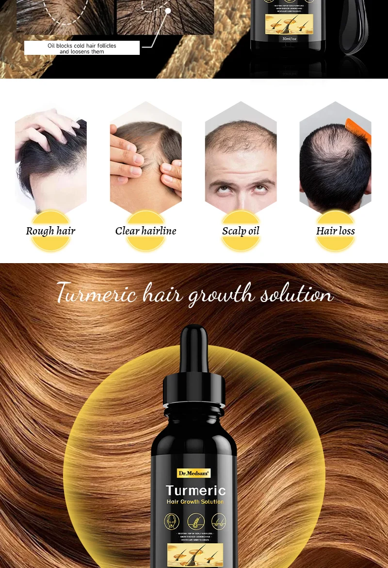 Hair Growth Serum Oil,Treatment Prevent Hair Loss Products,Massage ...