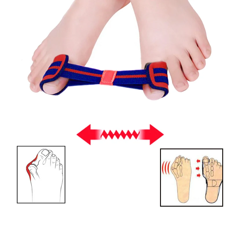 Correttore Per Alluce Valgo - Cinghia Elastica In Nylon Con Molla In Acciaio Per Allineare E Distendere L'Alluce, Antidolorifico Per Piedi