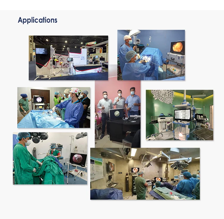 Medical Compact Laproscope Camera All-in-one FHD Surgical Video Endoscopic Imaging System ENT Video Endoscopy