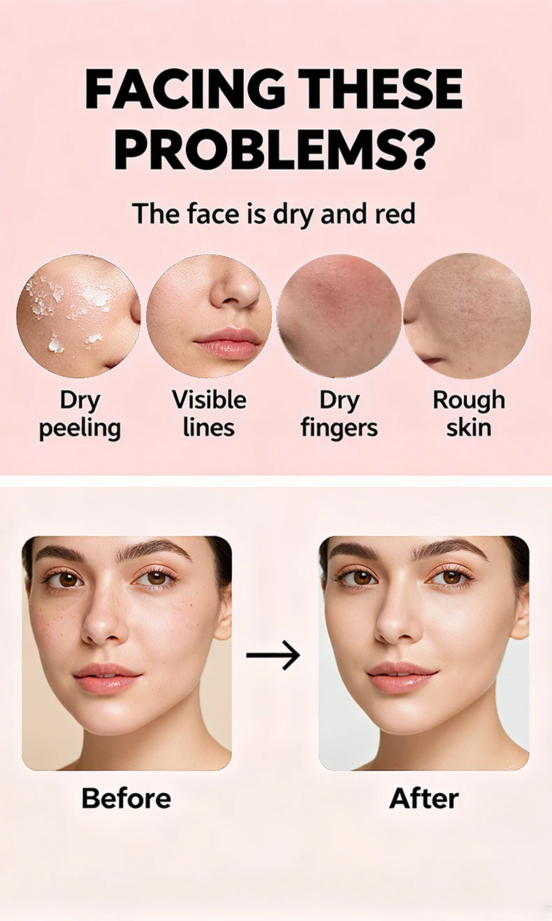 Wholesale Original Milk Essence Moisturizing Brightening Wrinkle Relieving Face Lotion(pic6)