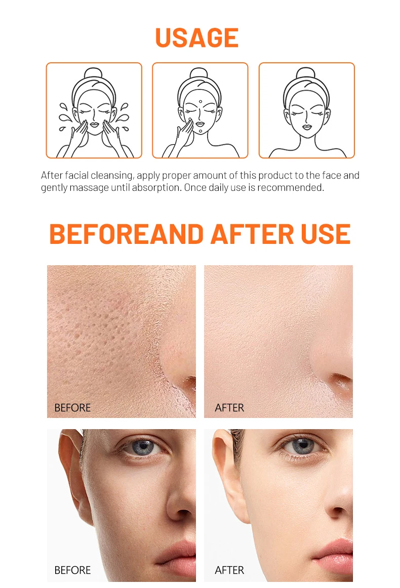 Hot Sale Vitamin C Niacinamide Face Serum for Face Skin Brightening Moisturizing Hyaluronic Acid Face Serum