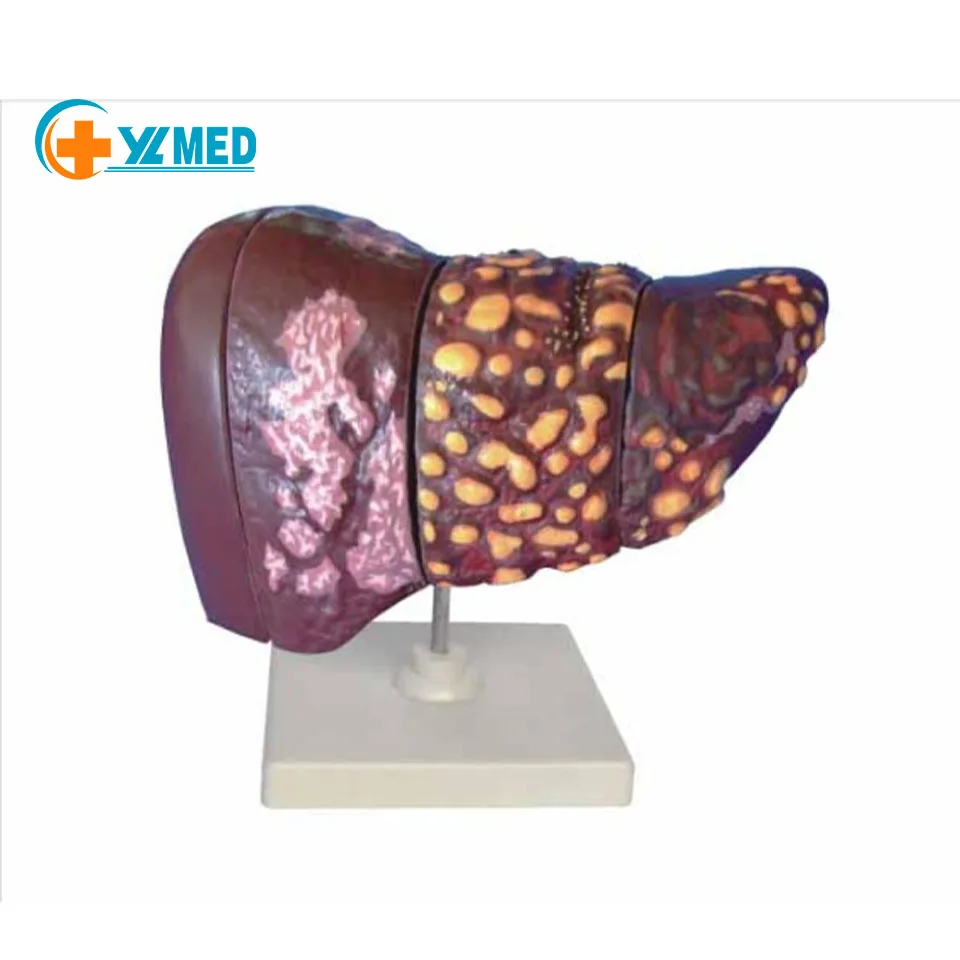 Медицинская научная модель человеческого заболевания печени медицинская обучающая для обучающего оборудования Обучающие ресурсы