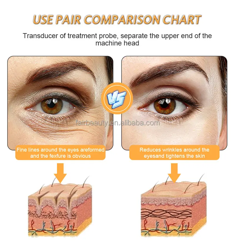 Cryotherapy Ice Hammer Soothing Handle