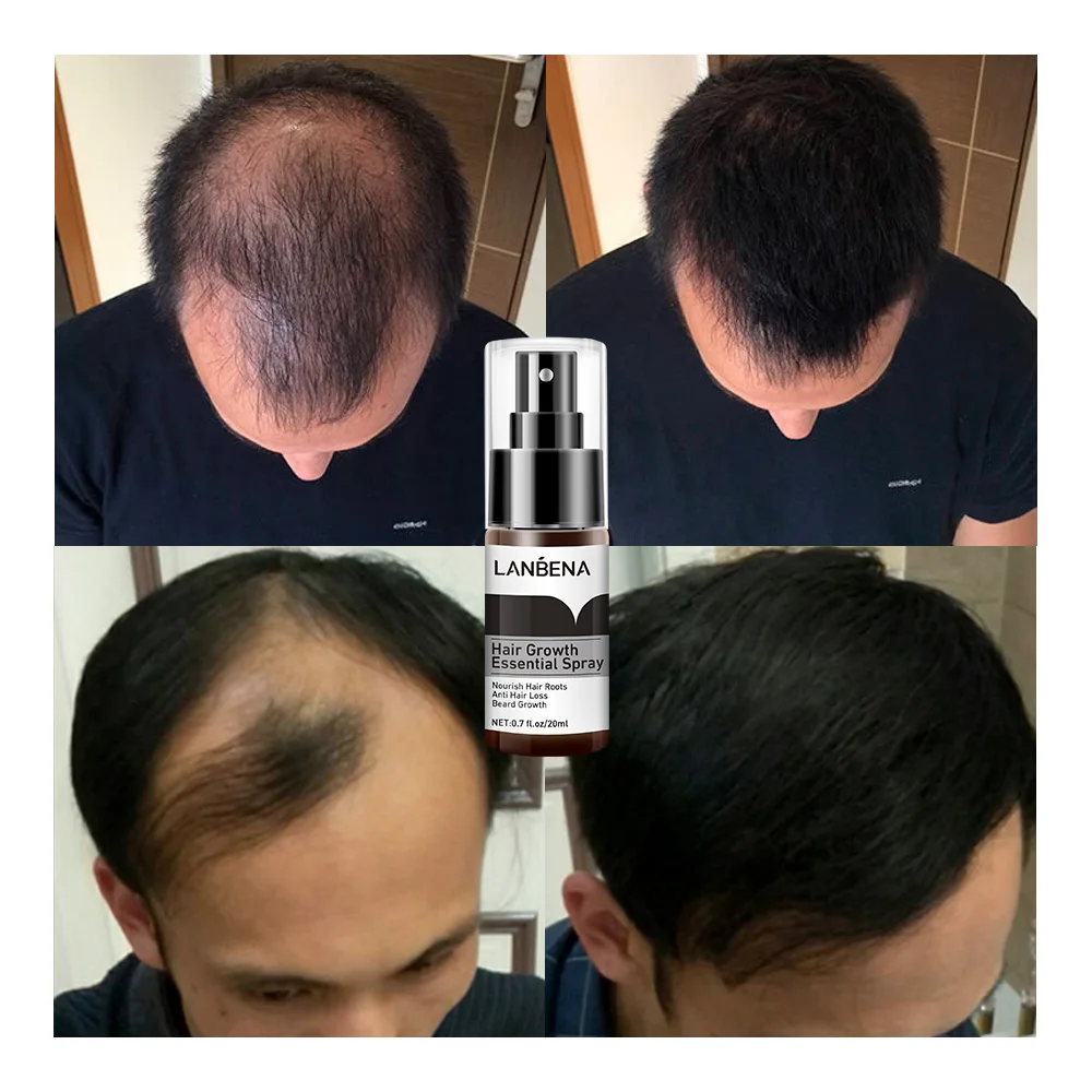 INSTANT HAIR GROWTH promises Quick  Instant Hair Growth  Facebook