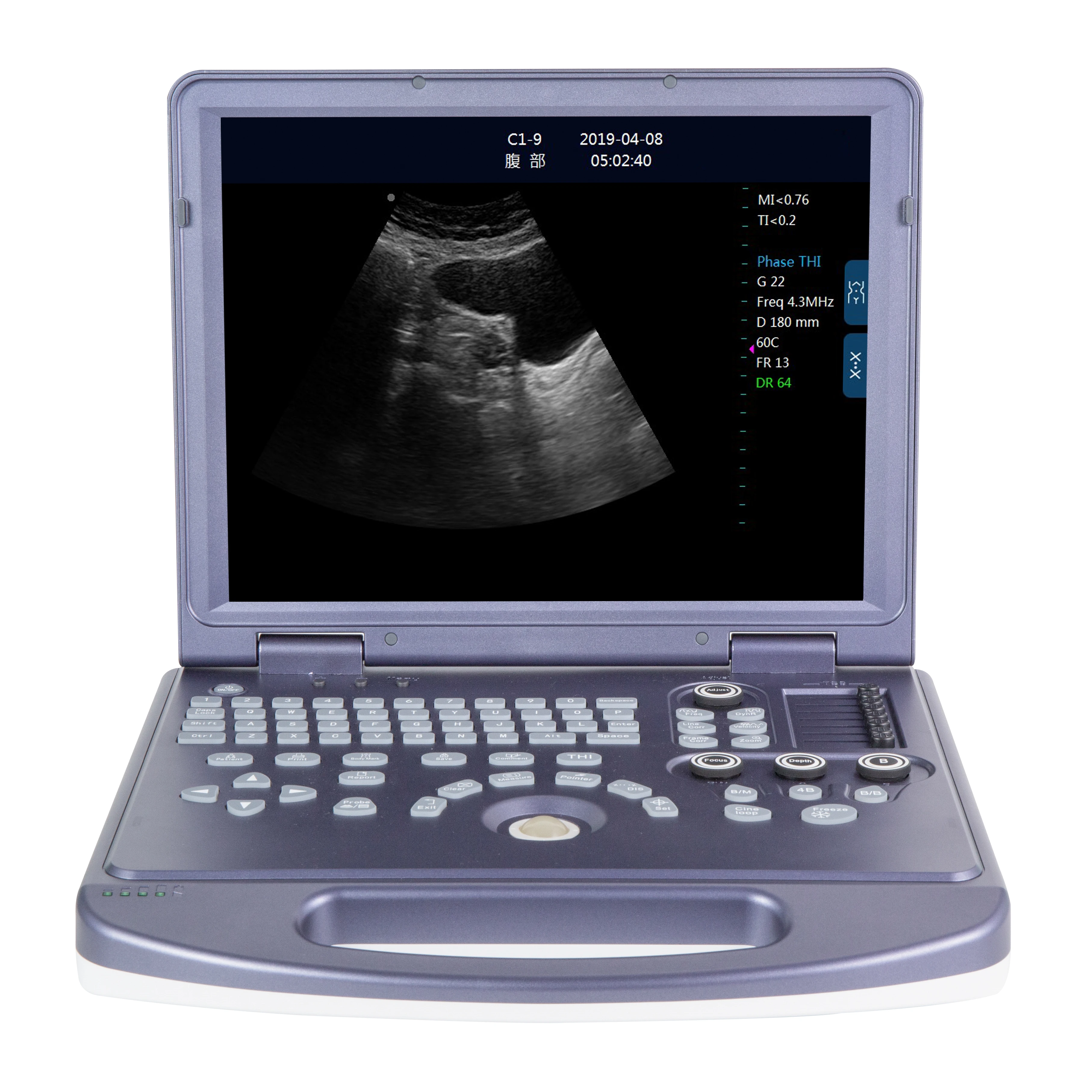 Медицинский сканер. DW 360 Ultrasound. SIUI CTS-800. Портативный УЗИ аппарат DW-mu15. УЗИ сканер для КРС Easi-scan.