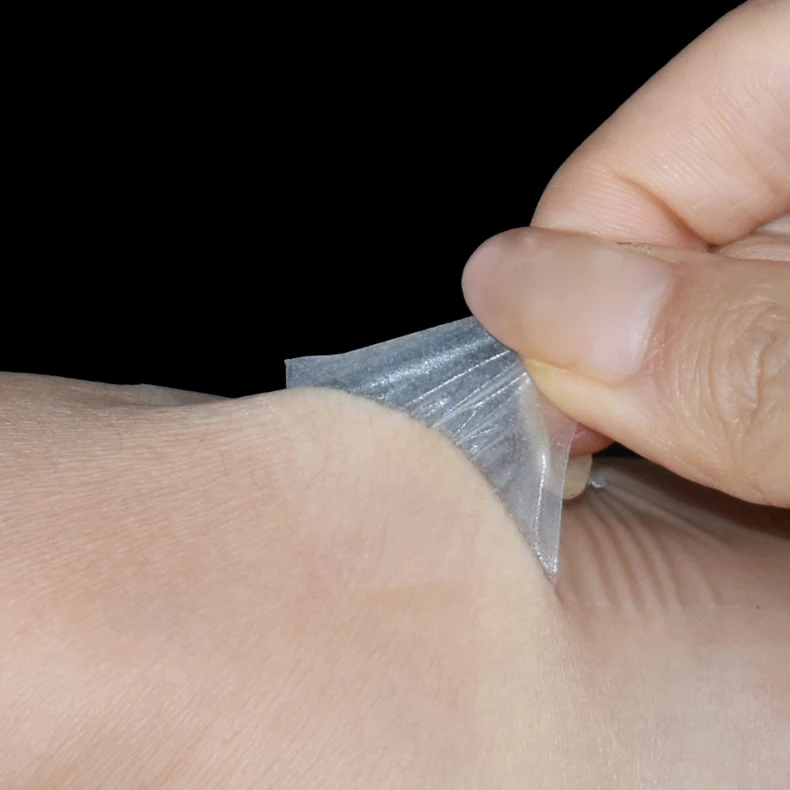 Wound Device Zip Wound Closure Wound Splice Closure