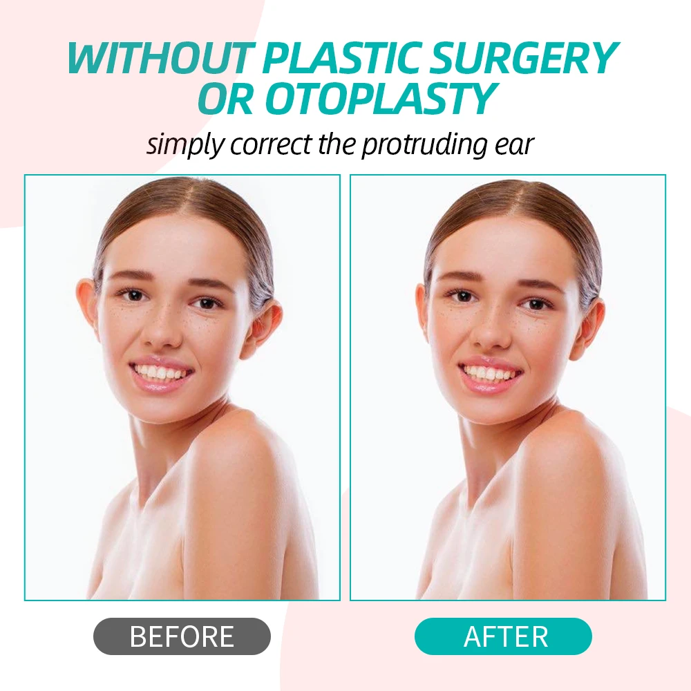 6Pcs/8PCS  a Set Ear Corrector Stickers  Make Ear Small Suitable for Children Adult Corrective Ear Care Products