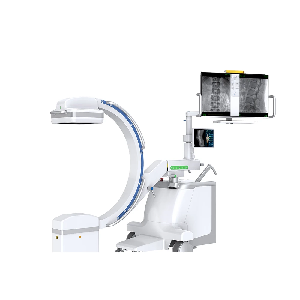C ARM X Ray Machine Provides Clear Images for Accurate Diagnoses