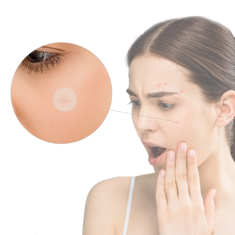 Acne Pimple Patch Absorbing Hydrocolloid Master Acne Patch