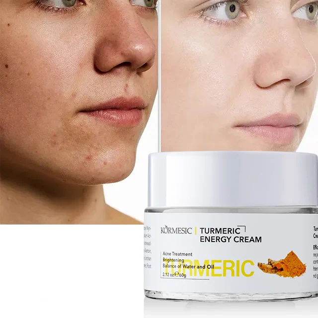 KORMESIC OEM Wholesale Private Label Skin Care Facial Cream Whitening Turmeric Energy Facial Cream
