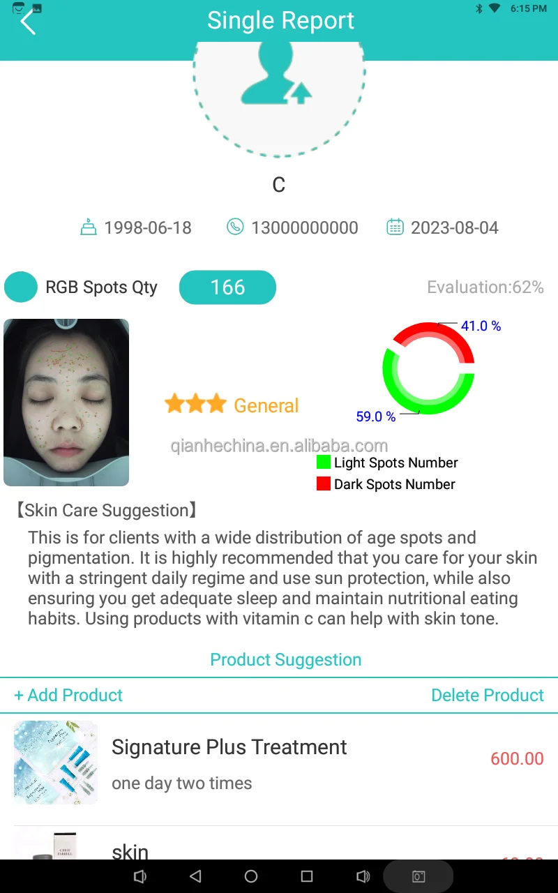 Advanced Professional Skin Scope Analysis Skin Diagnostic Equipment ...