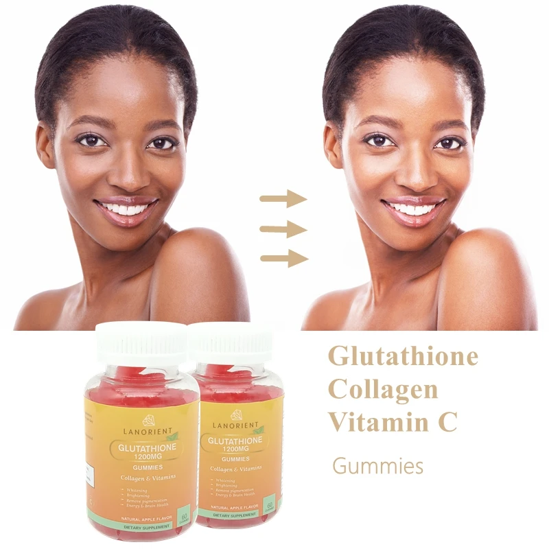 glutathione gummies skin whitening effectiveness What's Up Wellness with Vitamin C, Radiant & Youthful Reviews Online Glutathione Collagen Gummies - Brighten