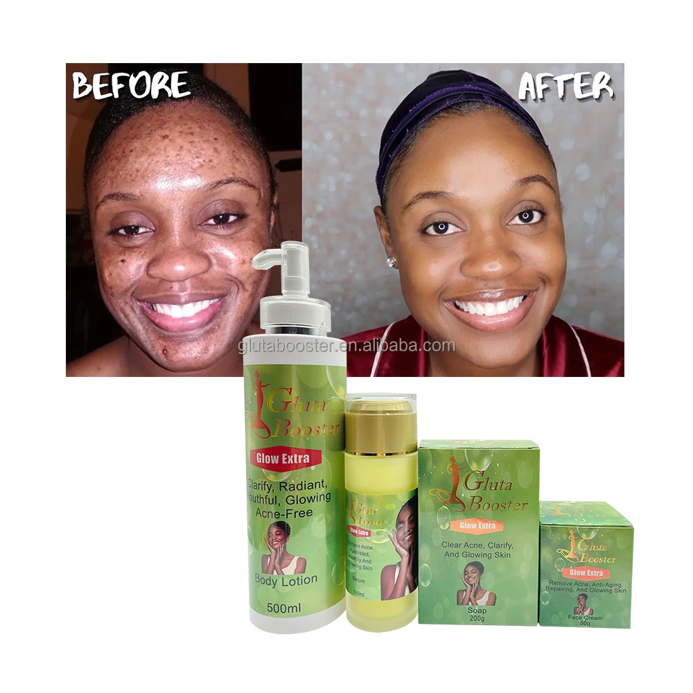 Skin Care Set For Glowing Skin Private Label Anti Acne Set Remove Pimples Clear Blemishes Clarify Repairing For African Beauty