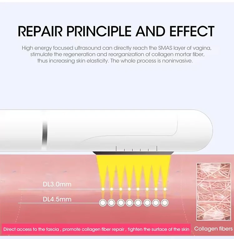 Professional High-Intensity Focused Ultrasound Vaginal Rejuvenation Device 3 Upgrade your clinic with a professional vaginal tightening HIFU machine. Featuring 3.0mm & 4.5mm cartridges for collagen remodeling, интим rejuvenation, and non-invasive tightening treatments. Professional High-Intensity Focused Ultrasound Vaginal Rejuvenation Device