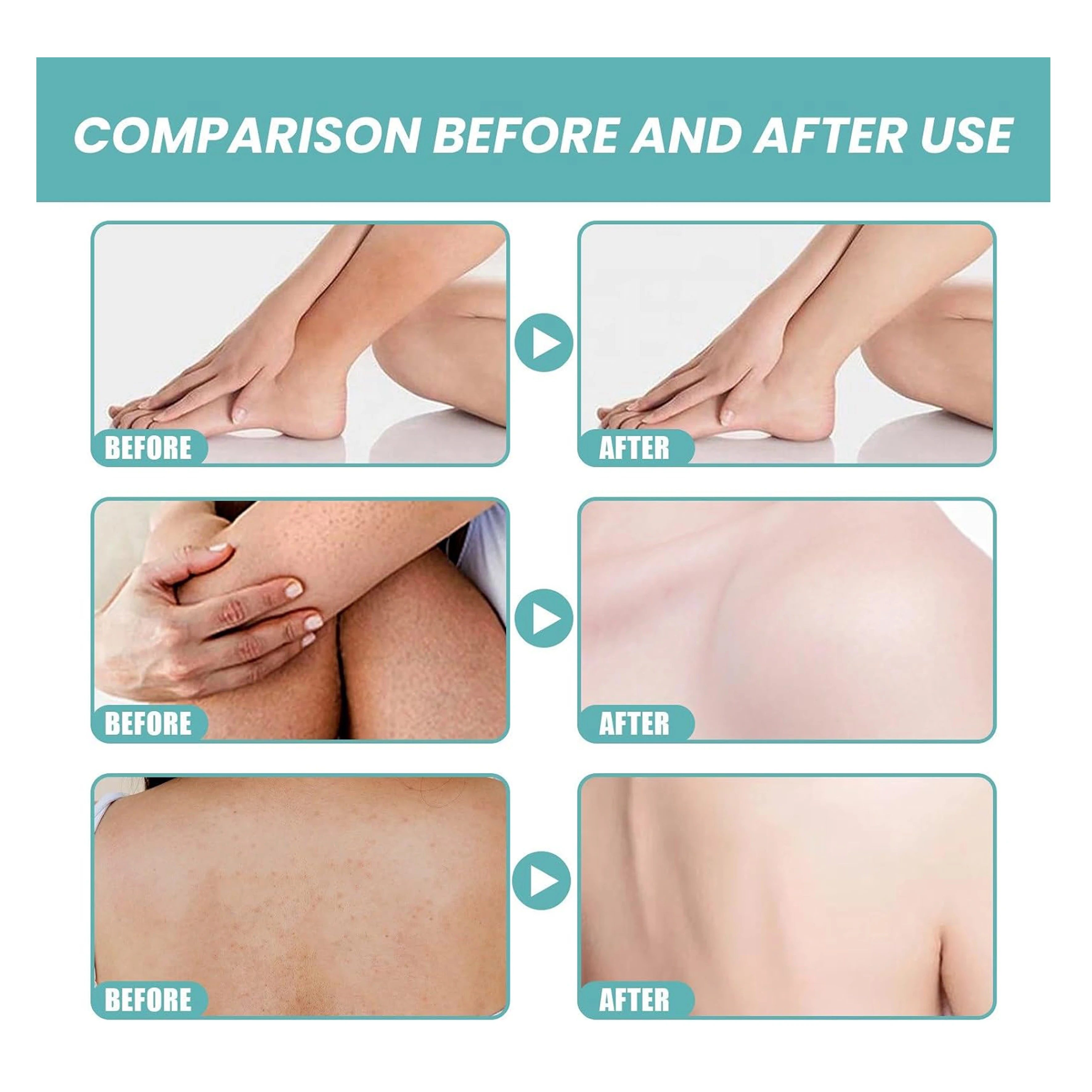 glutathione lotion before and after Roushun Niacinamide Acid Body Hyaluronic Acid Body Lotion Firming Moisturizer FUNCTION:Detox