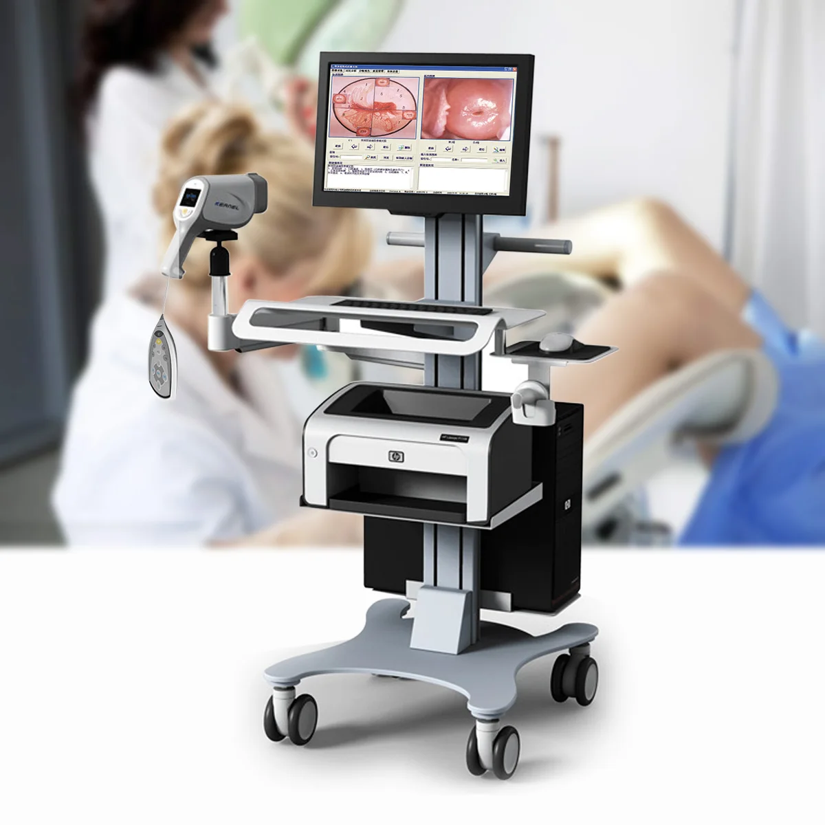 Kernel Colposcopy Examination Surgical Instruments Full hd Camera Colposcope Price Equipment for  Gynecology with Software