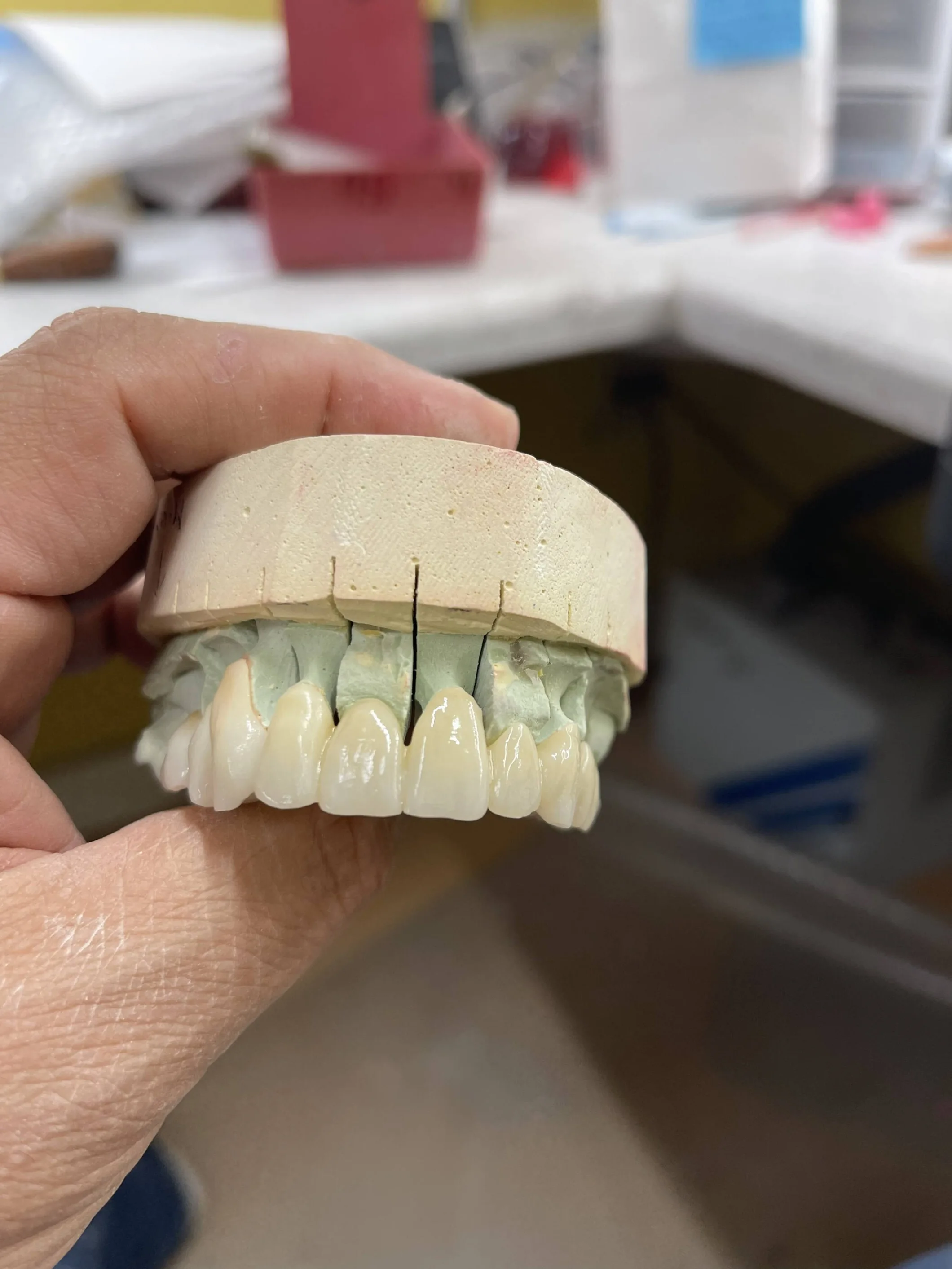 China Factory Price AG System Zirconia Blank 89mm ST Color Preshaded Dental Zirconium Blank