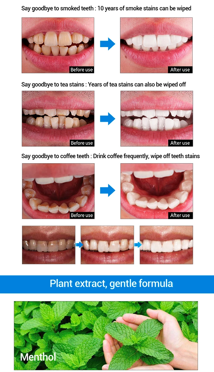 Lanbena Teeth Whitening Liquid For Remove Professional Easy White Teeth