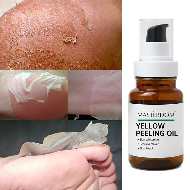 Oem African Extra Strong Bleaching Oil,Dard Skin Dark Knees Knuckles