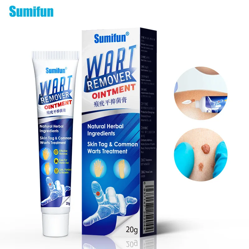 genital warts removal cream