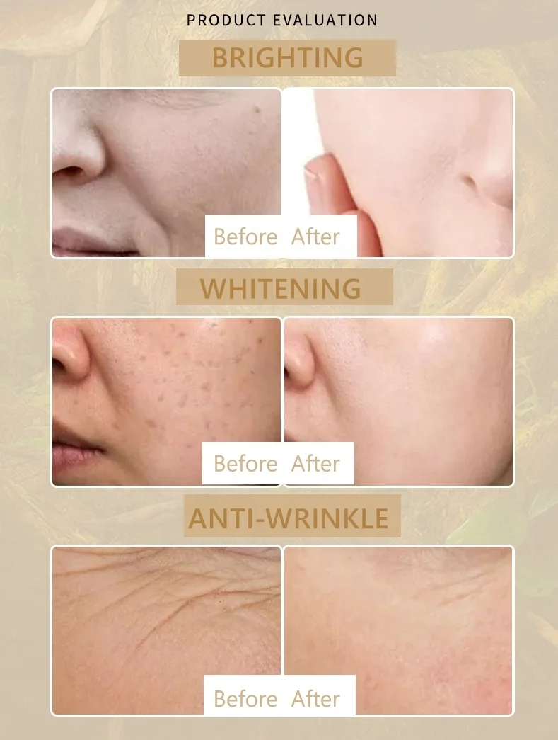 Private Label L-glutathione Vitamin C Facial Skin Care Sets Organic  Moisturizing Whitening Brighten Face Skin Care Set Natural| Alibaba.com