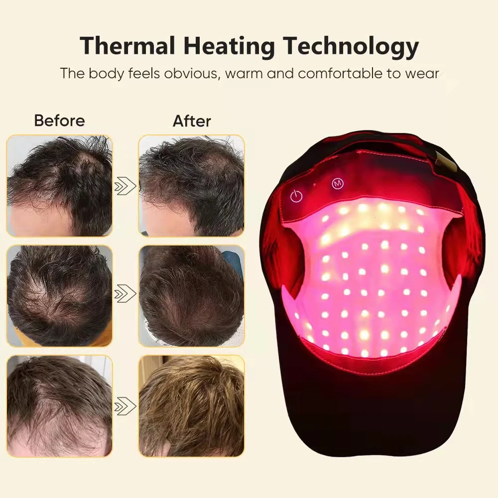Hot Sale Professional Infrared Hair Growth Products Red Light Therapy