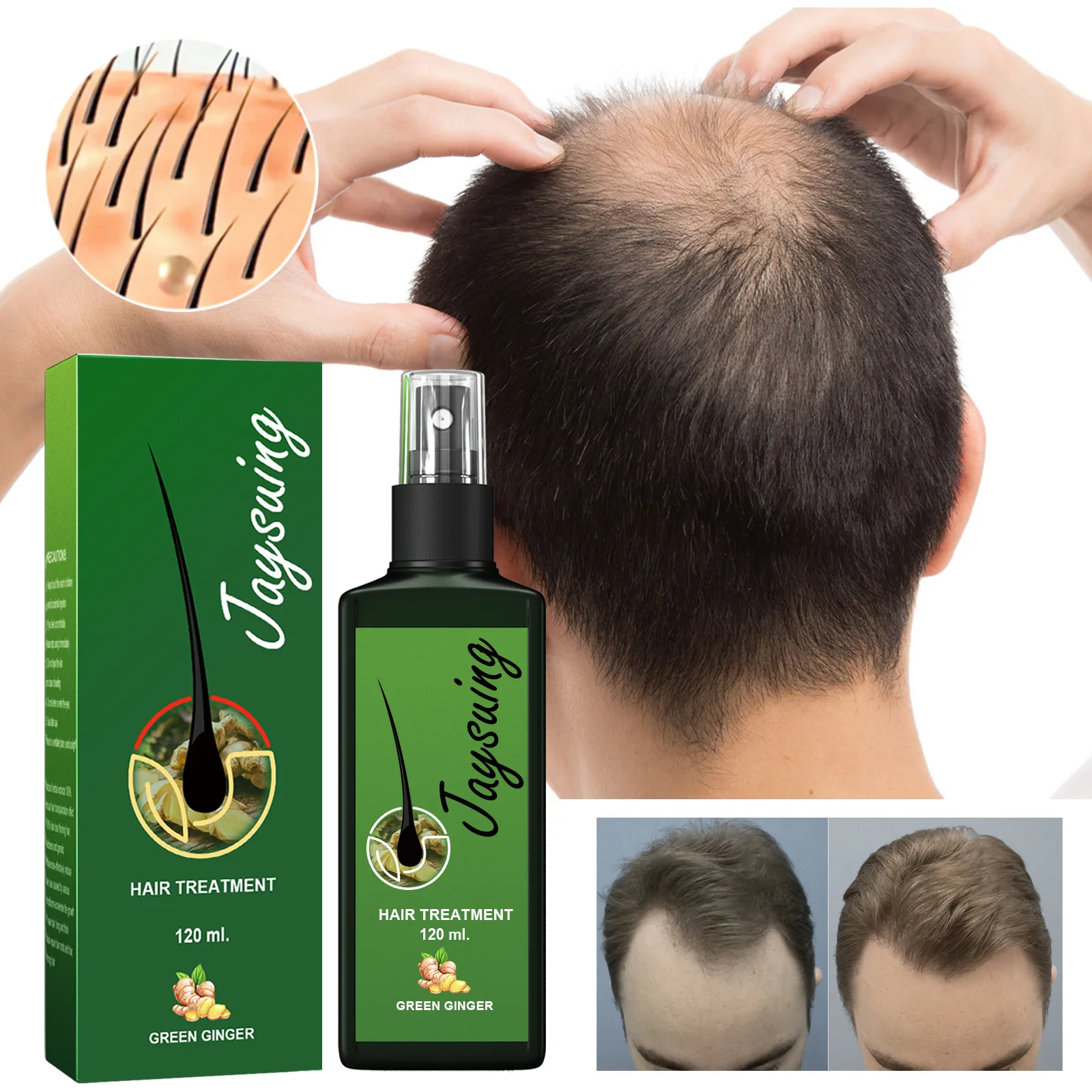 Jaysuing Hair Growth Spray Nourishing Root Hair Thick Growth Liquid ...