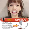 Mouth expander