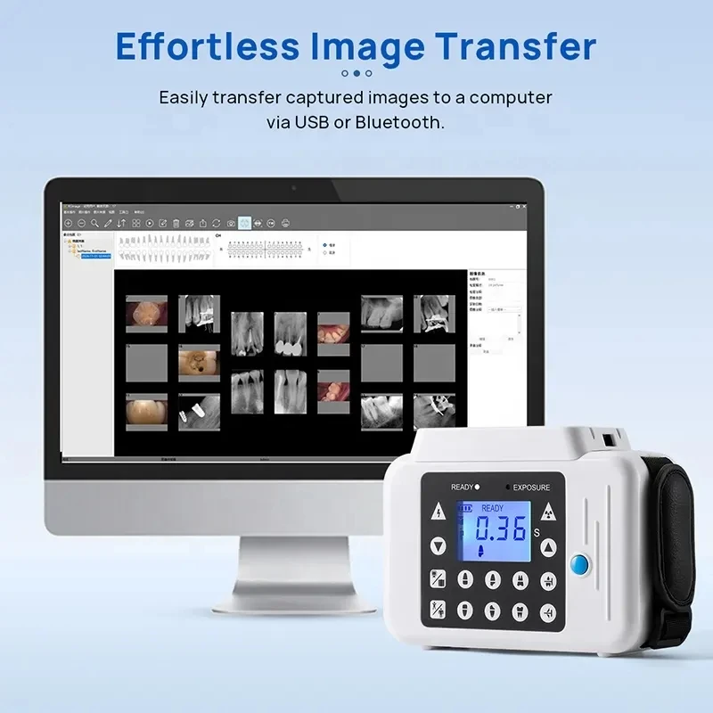 X Ray Produced Rvg App Vatech Dental Digital Ray X RVG Sensor with Two Sizes