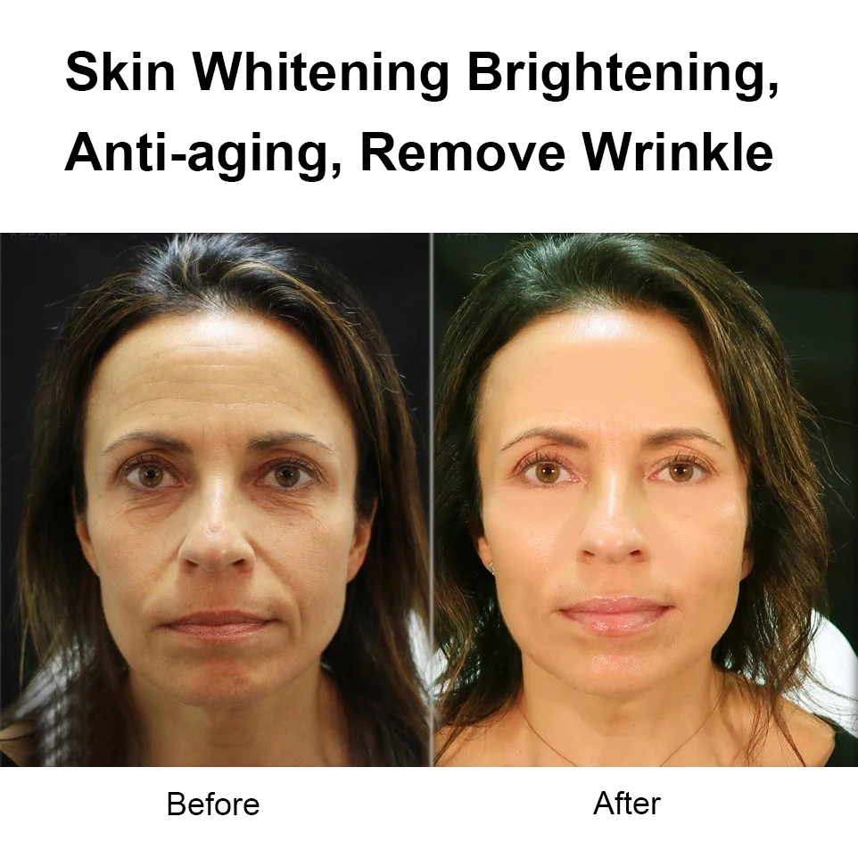 glutathione iv johannesburg Glutathione Injections & IV Drips