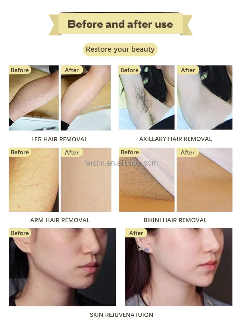 Accessory Kit for MedSpas