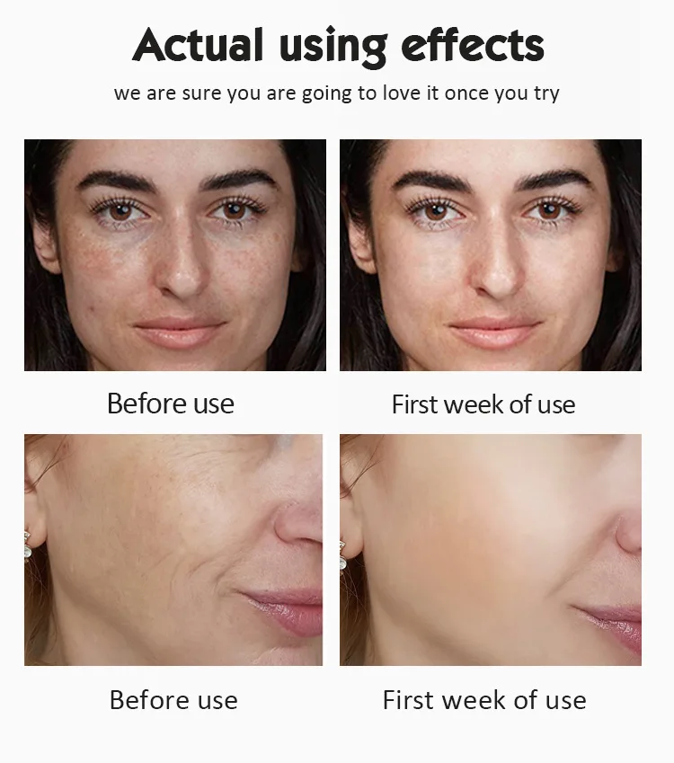 Facial Care Vit C Solution Whitening Ampoule Face Vitamin C Serum