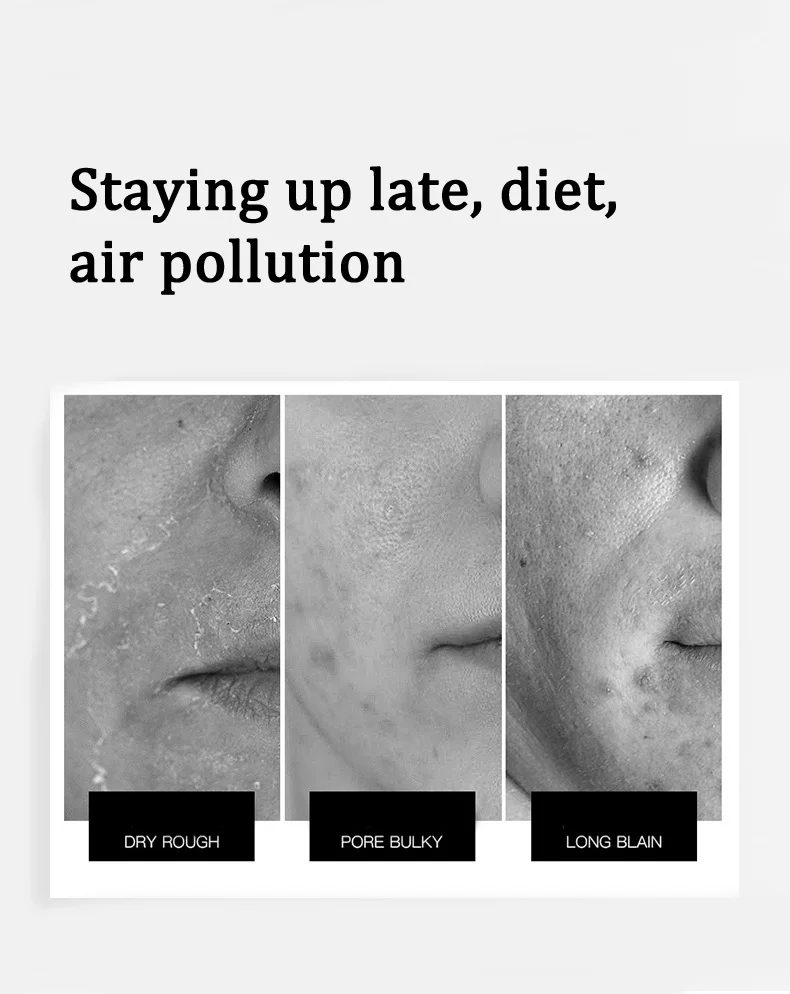 Simple Kind To Skin Refreshing Facial Cleanser Hello Clear Fwithout