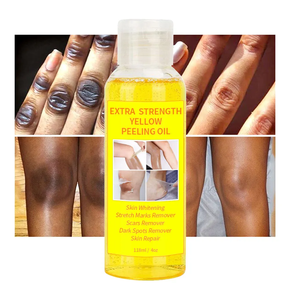 110 ml d'huile de pelage jaune extra forte huile de pelage blanchissant  éclaircir les coudes les genoux les mains la mélanine même le teint de la  peau et blanchir la peau 