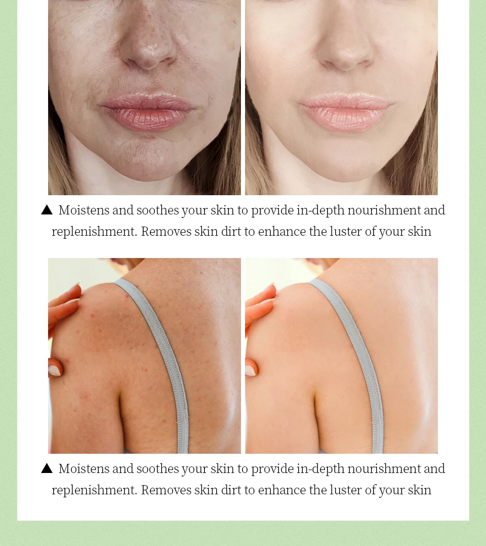 OEM Custom Logo Ointment Moisturizing Skin Cream Color Box Moisturize and Delay Aging; Effectively Remove The Black Eye All Age