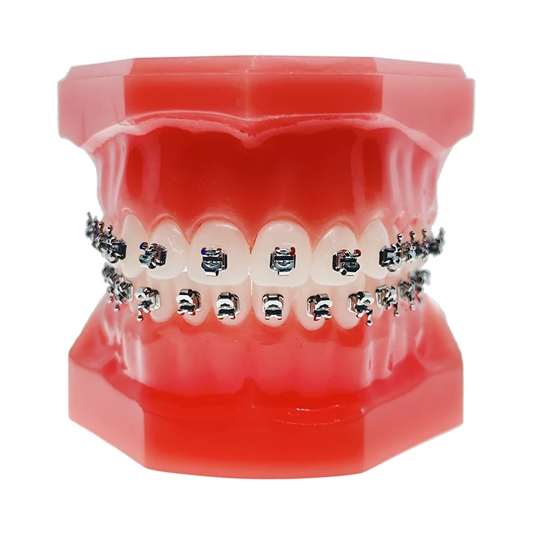 High Standard Orthodontic Dental Active 2G  Materials Braquets Autoligados