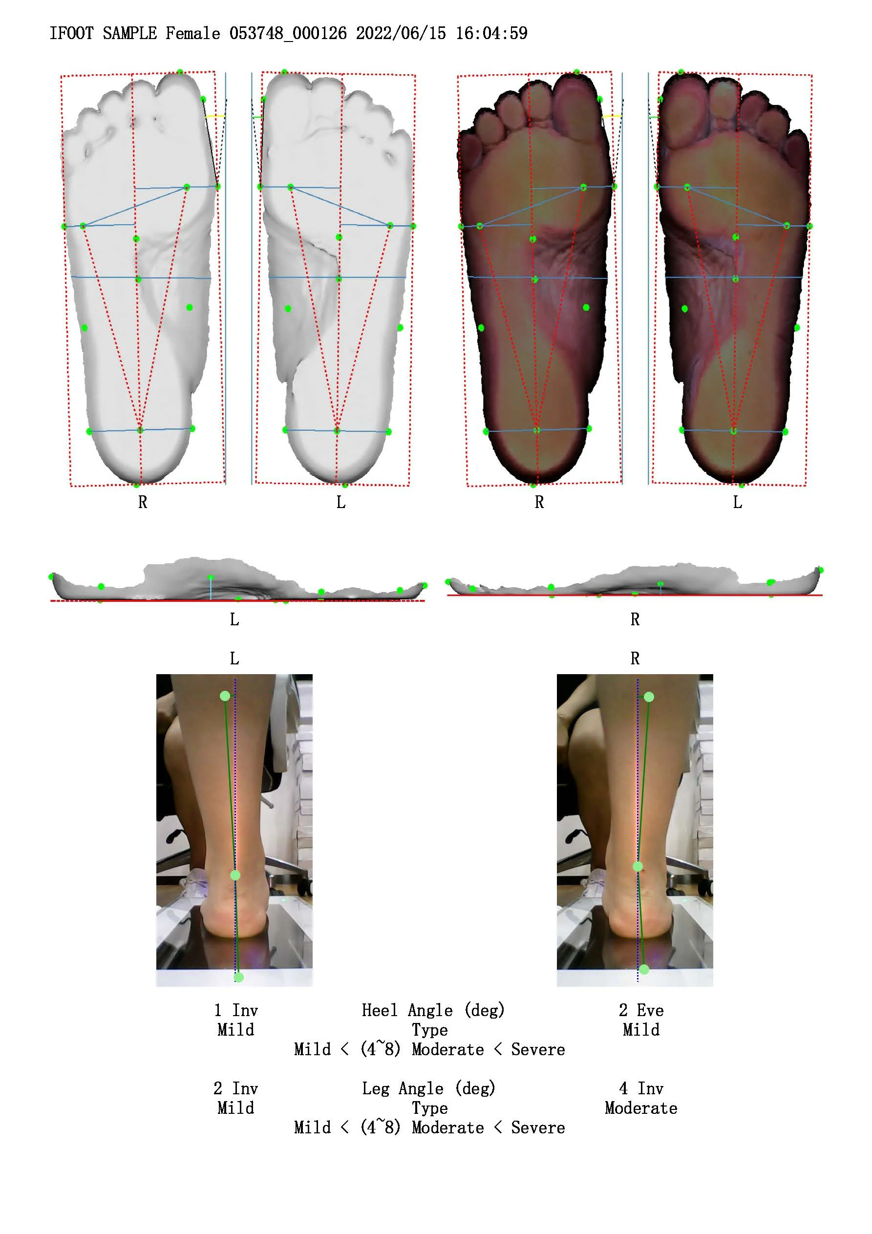 Isun3d 3d Foot Scanner With Multifunctions Can Scan Foam Box And Foot